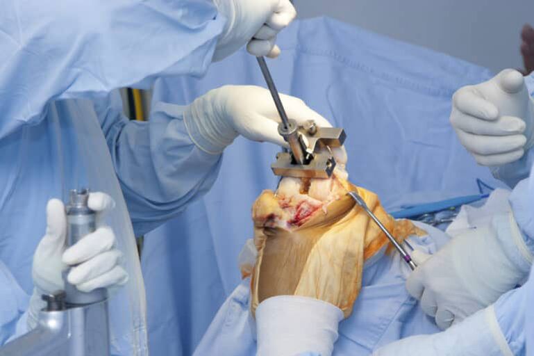 Cirugía de osteoartritis de rodilla