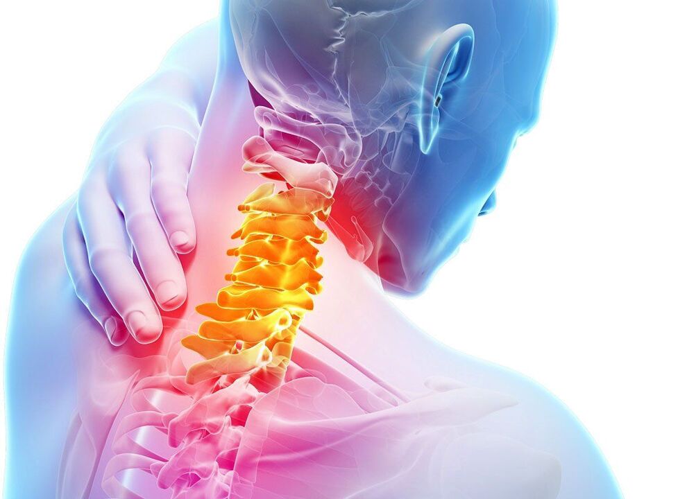 Síntomas de la osteocondrosis espinal. 