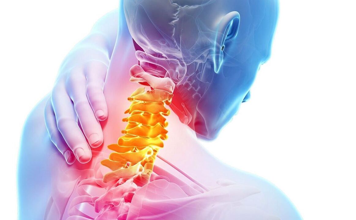 Dolor en la osteocondrosis cervical.